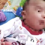 Bayi 2 Bulan Jalani Operasi Pembuatan Lubang Anus