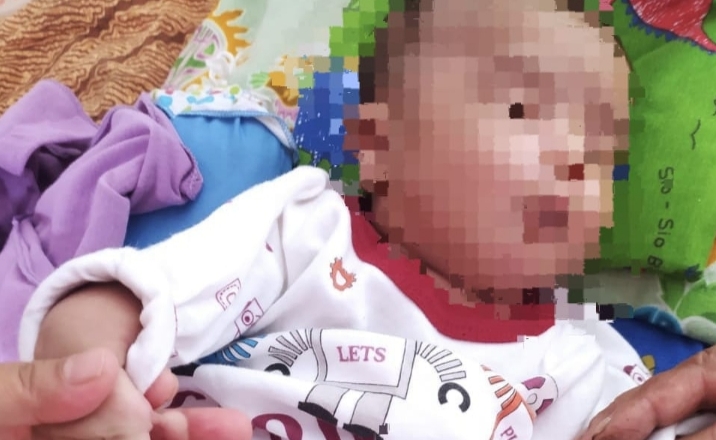 Bayi 2 Bulan Jalani Operasi Pembuatan Lubang Anus